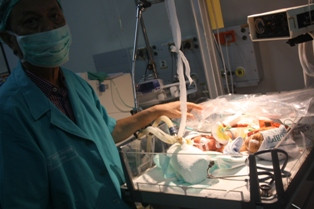 RS Soetomo Tangani Bayi Kembar Siam Ke-72