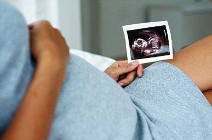 Ibu Hamil, Sebaiknya Hindari Mendengar Berbagai Mitos