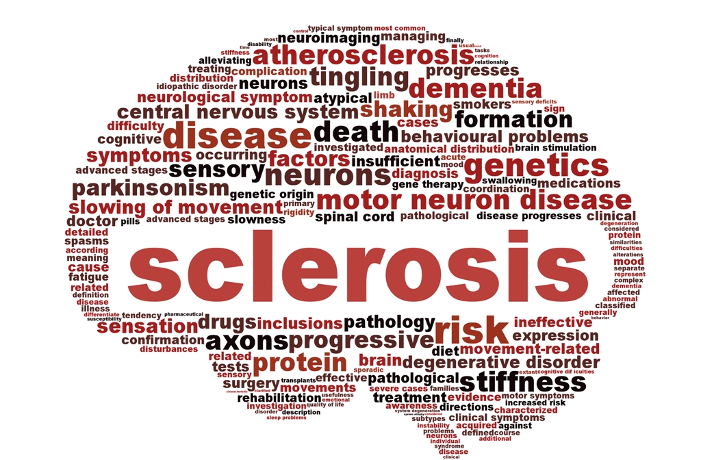 Multiple sclerosis dijuluki penyakit seribu wajah (Foto:Shutter Stock)