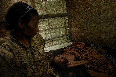 Lebih 2.000 Balita di Kendal Kekurangan Gizi