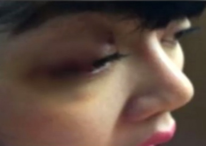 Dita Masih Trauma Akibat Pemukulan 