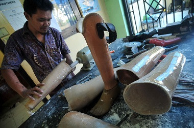 Ratusan Kaki Palsu akan Diberikan ke Warga Penyandang Disabilitas di Sumut