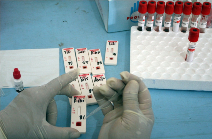 101 Orang di Penjaringan Mengidap HIV