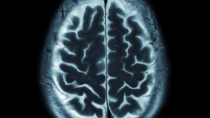 Kecanduan Media Sosial? Ini Penyebabnya 