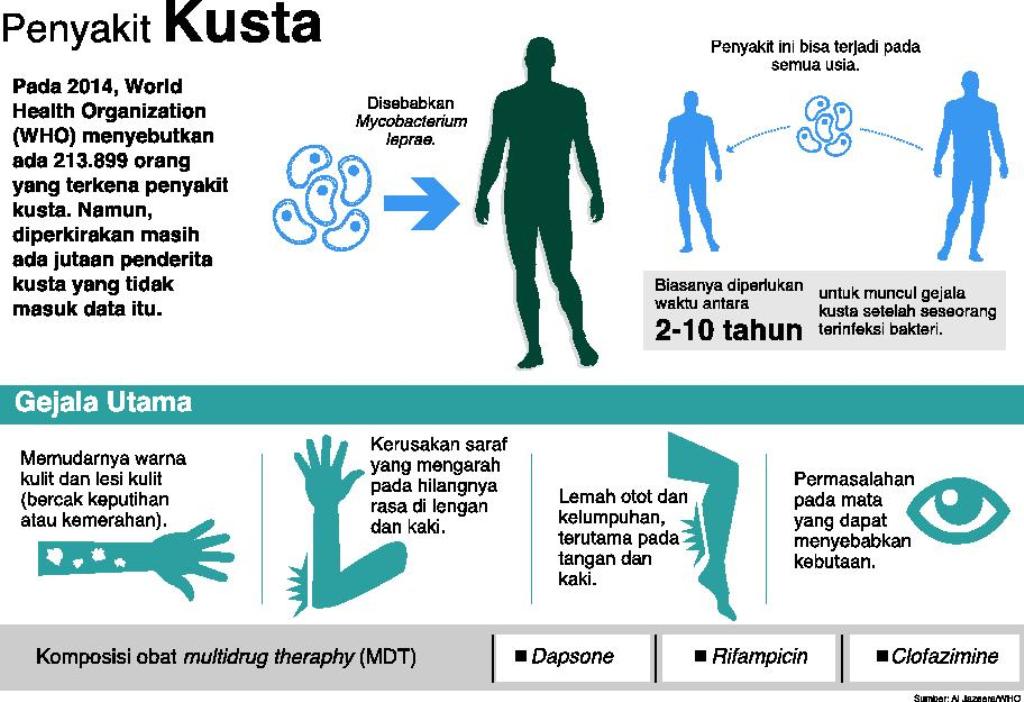 Grafis: Penyakit kusta/MI