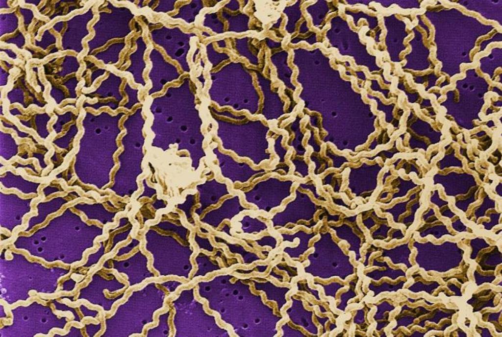 Bakteri Leptospira. Foto: Wikipedia