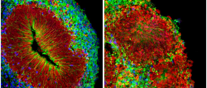 Remaja 16 Tahun Berhasil Membuat Mesin Penumbuh Otak Mini