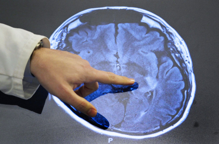 2 Laboratorium AS Lakukan Eksperimen untuk Bangkitkan Orang Mati