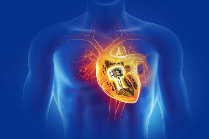 Hati-Hati, Motor Matikmu Bisa 'Sakit Jantung'!