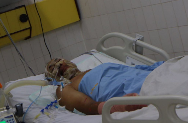 Alasan Warga Nekat Masuk ke Zona Merah Sinabung