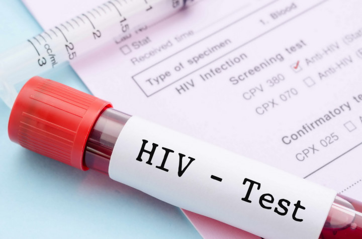 Meski Rutin ke Dokter, Banyak Anak Muda Enggan Lakukan Tes HIV