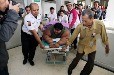 Bupati Purwakarta Jenguk Bocah Obesitas di RSHS Bandung