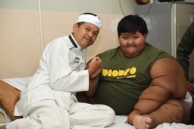 Jenguk Bocah Obesitas, Bupati Purwakarta Bawakan Apel dan Buku