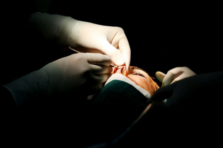 Indonesian Cosmetic Surgery Industry Comparable with Foreign Countries