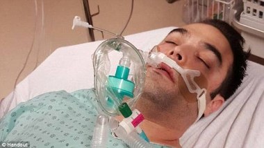 Pelayan Dipolisikan karena Hidangkan Salmon kepada Penderita Alergi