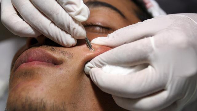 Illustration (Photo: Tang Chhin Sothiya/AFP/Getty Images)