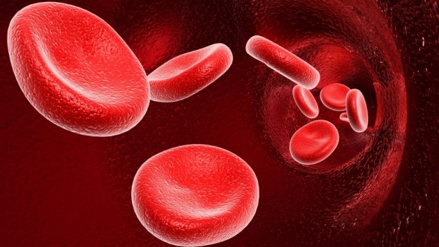 Mengenal Penyakit Leukemia Granulostik Kronik