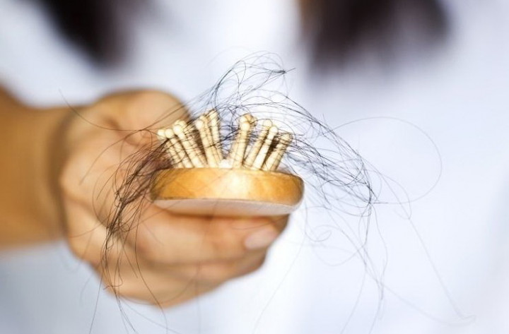 7 Makanan Ini Ampuh Mengatasi Rambut Rontok