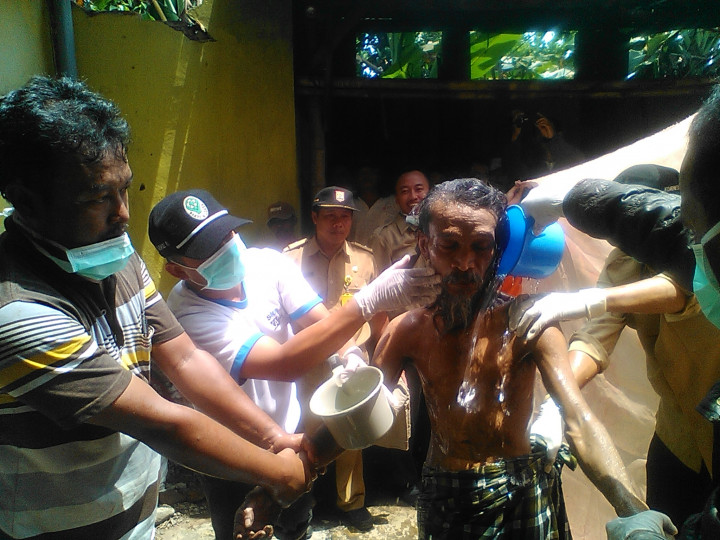 30 Tahun Dipasung, MS Akhirnya Dibawa ke RSJ