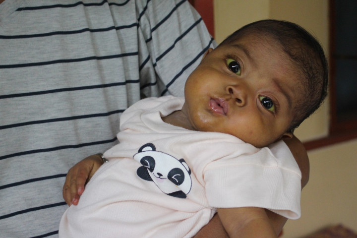 Derita Atresia Bilier, Bayi Ini Butuh Rp1 Miliar untuk Transplantasi Hati