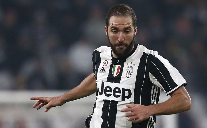 Higuain Diragukan Tampil Lawan Sevilla