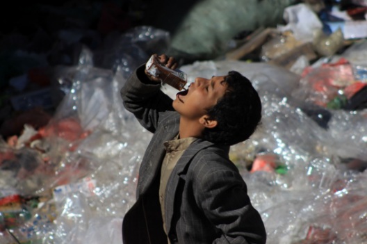 2,2 Juta Anak di Yaman Derita Kelaparan Akut