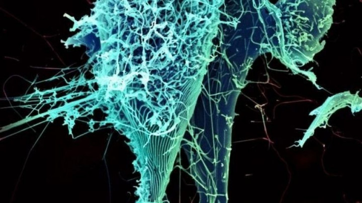 Studi: Ebola Dapat Bersembunyi dan Berkembang dalam Paru-paru