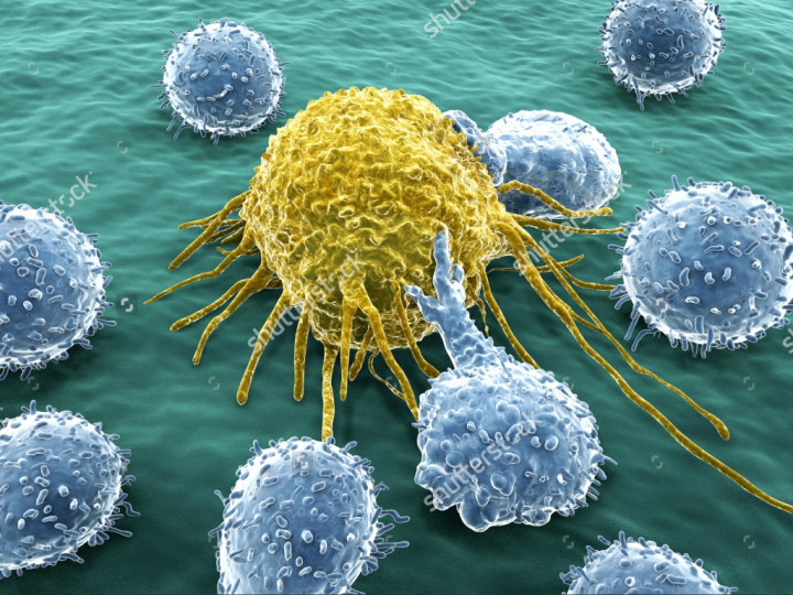 MPS, Penyakit Langka Berbiaya Mahal