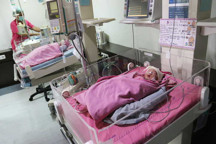 Bayi Kembar Empat Lahir di Medan