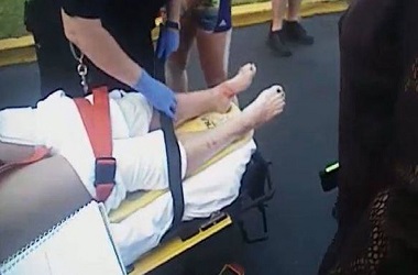 Pukul Wajah Hiu, Remaja Putri Selamat dari Maut