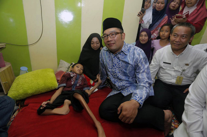 Emil Bantah Menelantarkan Bocah Pengidap Kelainan Tulang