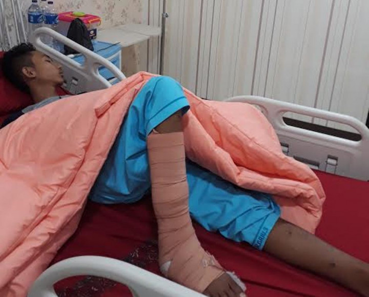 Korban Bom Kampung Melayu Berangsur Pulih