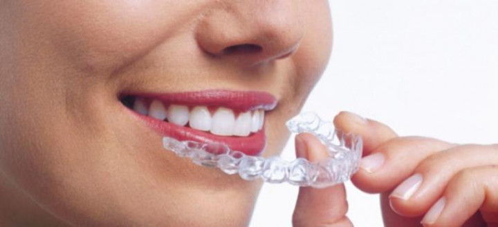 Tips Mengurangi Bruxism Tanpa ke Dokter Gigi