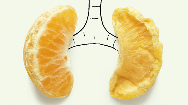 Perokok Pasif Juga Berpotensi Terkena Kanker Paru-paru