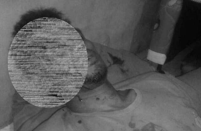 Anggota Polda Sumut jadi Korban Penganiayaan