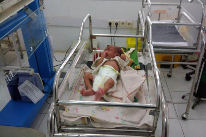 Bayi di Gunungkidul Didiagnosis Gizi Buruk