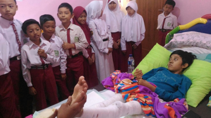 Siswa dengan Dua Kaki Melepuh dapat <i>Homeschooling</i>