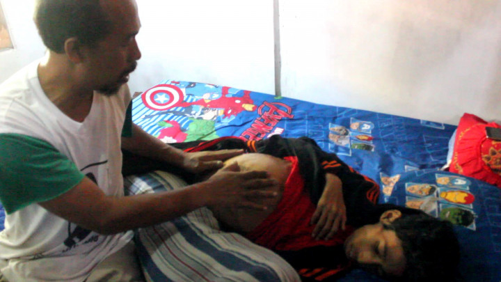 Bocah Berprestasi Lunglai Digerogoti Kanker Hati