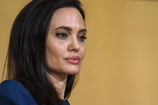 Mengenal Bell's Palsy, Penyakit yang Sempat Diderita Angelina Jolie