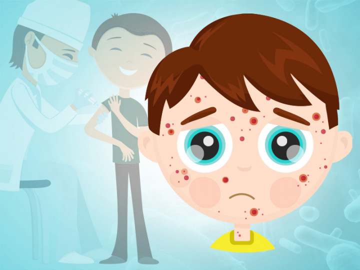 Infografik: Waspada Virus Rubella