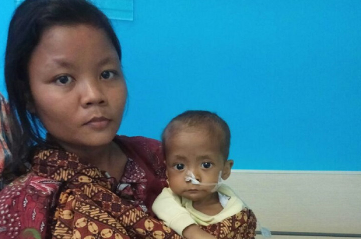 Bayi Penderita Gizi Buruk di Deli Serdang hanya Minum Teh