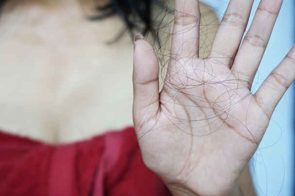 Duh! Polusi Udara Menyebabkan Rambut Lepek dan Rontok