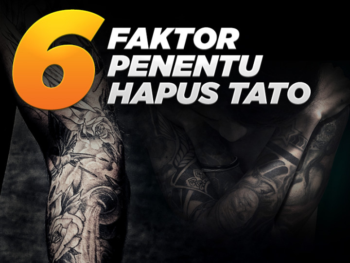 Infografik: 6 Faktor Penentu Hapus Tato