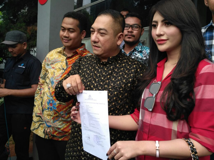 Model Laporkan Pencatutan Foto ke Katalog Alexis kepada Polisi