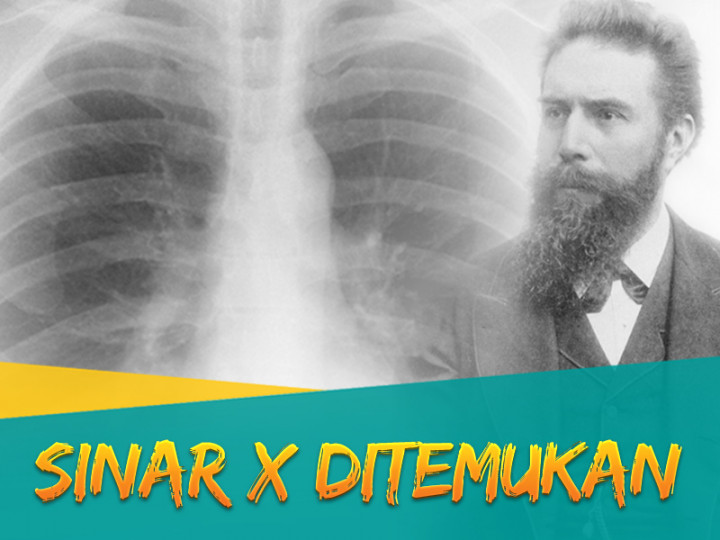 Hari Ini: Sinar X Ditemukan