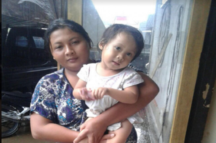 Balita Lumpuh di Pengungsian Erupsi Gunung Agung Butuh Bantuan