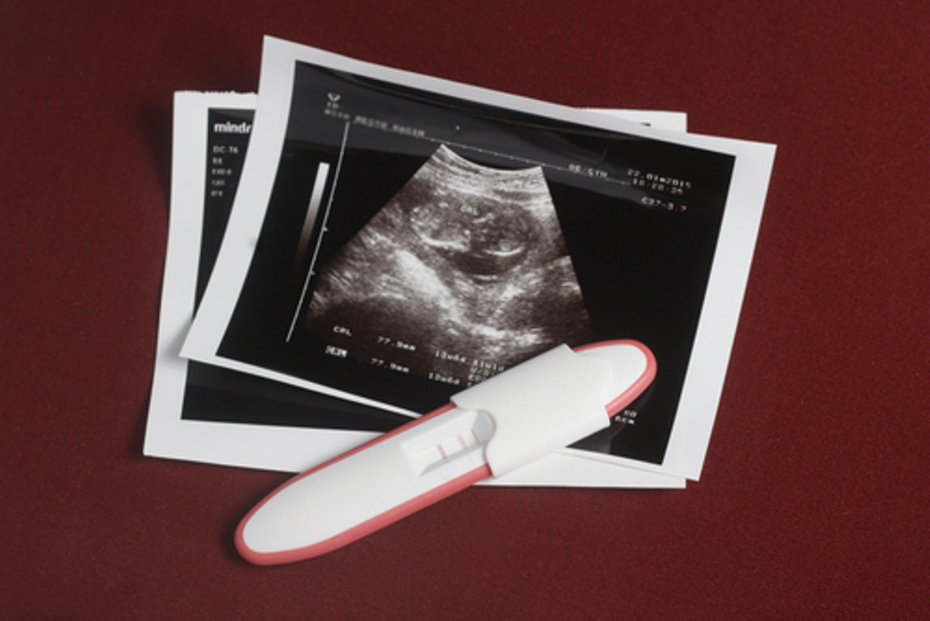 (Foto: Shutterstock)