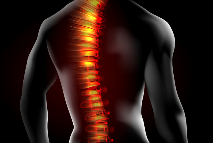 Tips Sederhana Menjaga Kesehatan Tulang Belakang