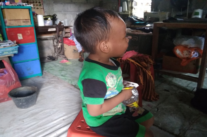 Ibu di Sleman tak Tahu Anaknya Menderita Kurang Gizi