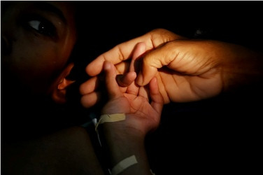 Kemiskinan Penyebab Tingginya Gizi Buruk di Brebes